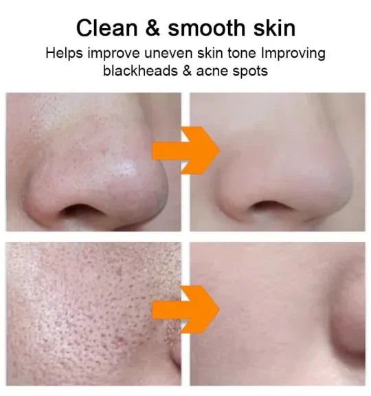 ORANGE ENZYME GENTLE EXFOLIATING GEL