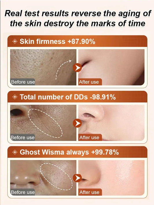 🔥Last Day Buy 1 get 1 free 🔥Ecdoin anti-aging essence