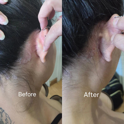 🏆Flash Sale⚡Revive + Restore Scalp Scrub