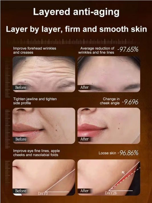 【One touch to remove wrinkles】Micro-molecular collagen anti-wrinkle lotion