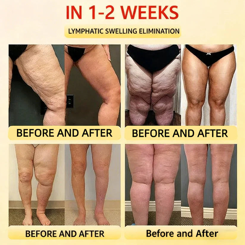 🎉 Limited-time offer – huge discount! 💰 Alisanda™ Self-regulating tourmaline shaping shorts with titanium fiber