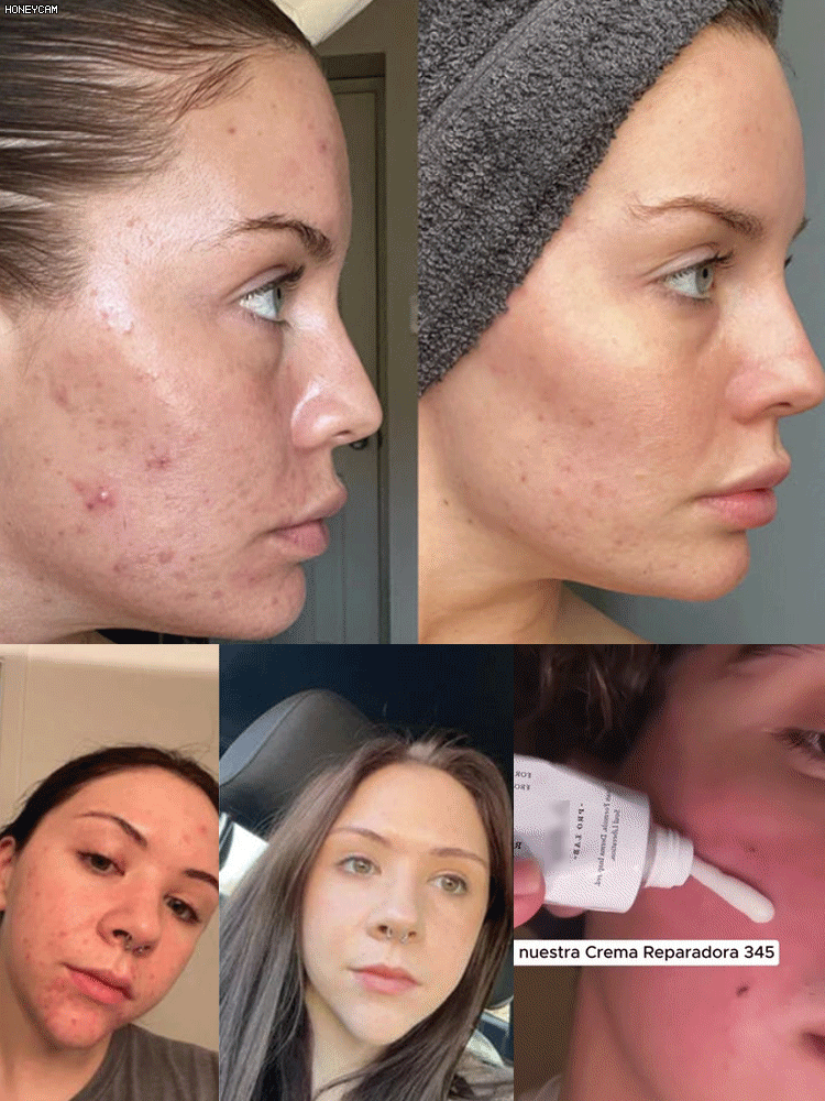 💥BUY 1 GET 1 FREE💥 Hydrating and Nourishing Face Cream 345