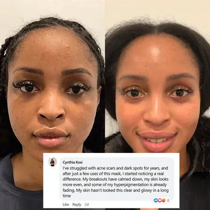 Pamper Yourself — Buy 2 Collagen Night Masks, Get 1 Free! Wake Up to Youthful, Hydrated Skin!