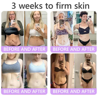 ✨LAST DAY BUY 1 GET 1 FREE✨ HISKIN PDRN Multi-Peptide Massaging Body RollerCream Visibly Firmer Anti-aging, Lifted Skin in 72 Hours — No Needles, No Clinic Visits